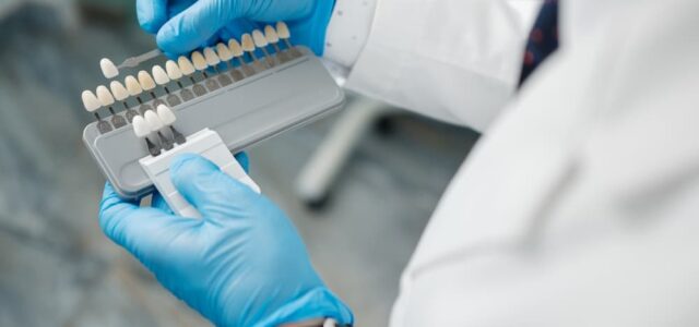 Veneers vs Teeth Whitening and Bonding