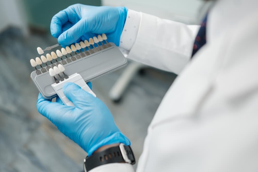 Veneers vs Teeth Whitening and Bonding