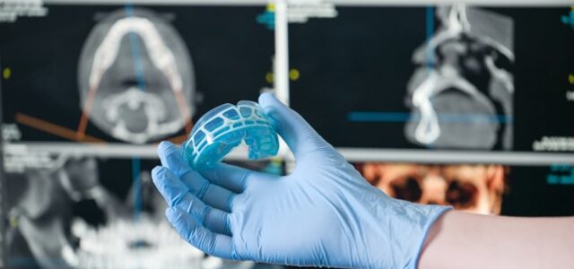 Mouthguards for Bruxism