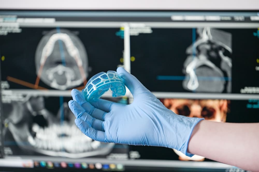 Mouthguards for Bruxism