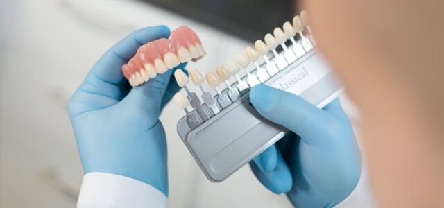 veneers and crowns