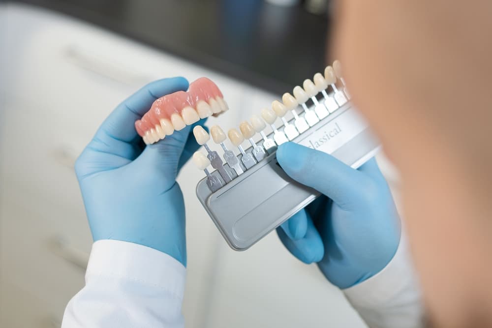 veneers and crowns