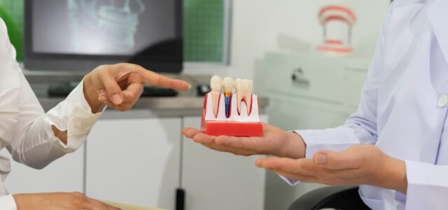 dental implants implants