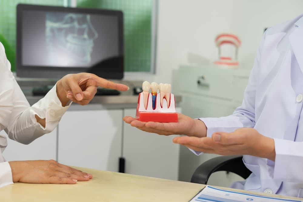 dental implants implants