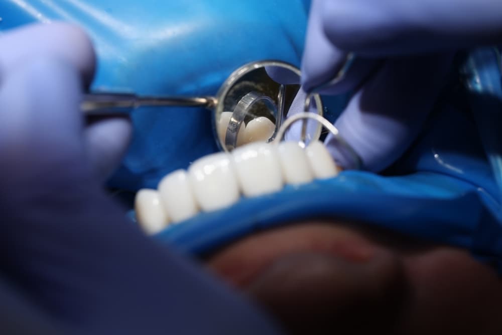 dentist point cook